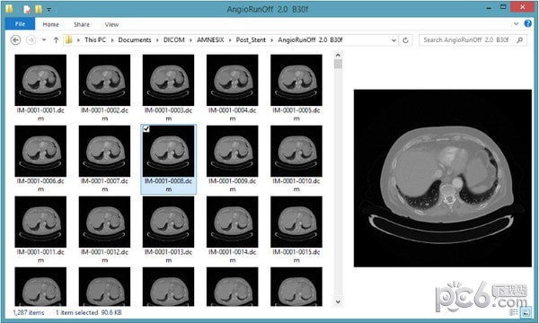 DICOM Thumbnailer(dicom缩略图查看工具)下载 v1.7.0官方版