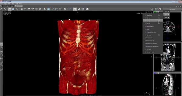 医疗影像3D软件-医三维下载 v1.0.0官方版