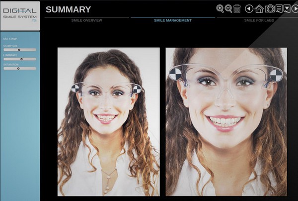 Digital Smile System(数字微笑系统)