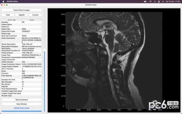 DICOM Vision for Mac-DICOM Vision Mac版下载 V1.0