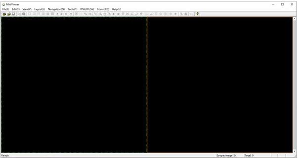 -MiniViewer(DICOM影像浏览转换器)下载 v1.0免费版